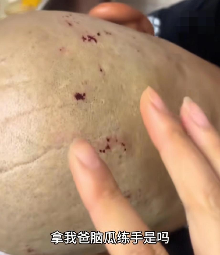 这爹的“心软”，看得我又好笑又心疼！

刚剃完光头，脑瓜顶全是小伤口，女儿气得吐