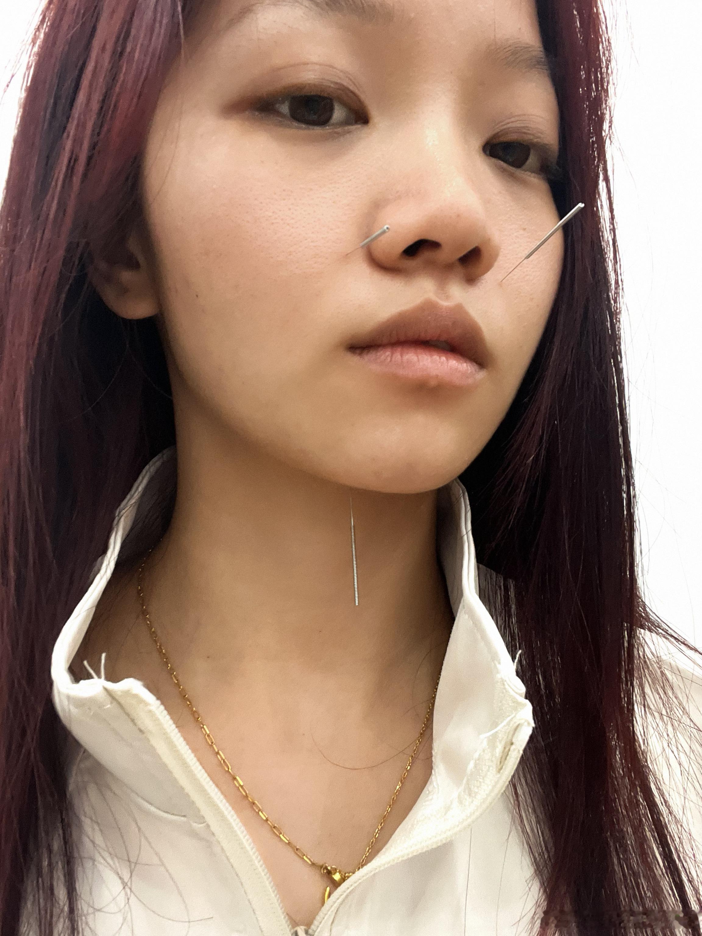 医生一边扎一边说不疼 扎一下我抖一下 我说还是有点疼的医生说我咋不疼呢？我说难道
