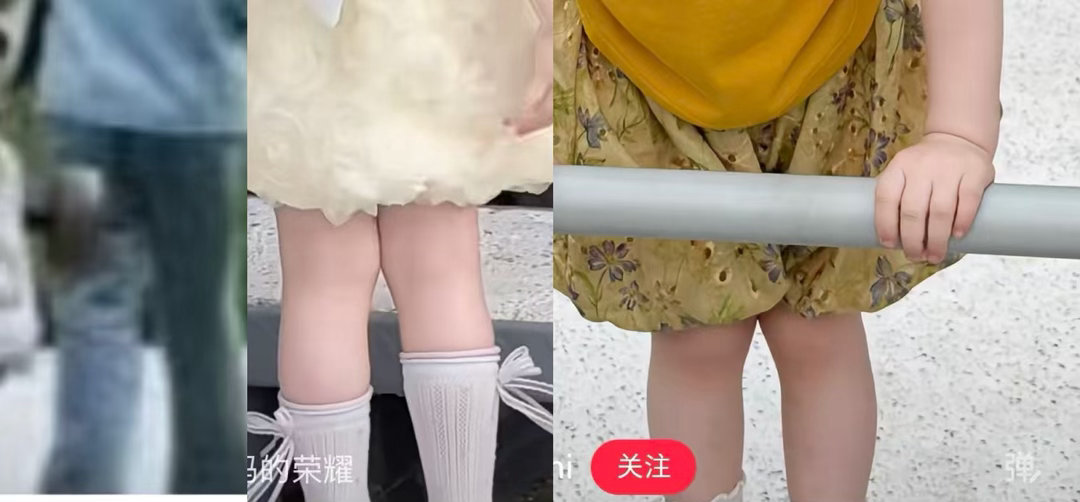 谁家膝盖内扣2岁96cm小女孩  专栏 · 豆荚笑话