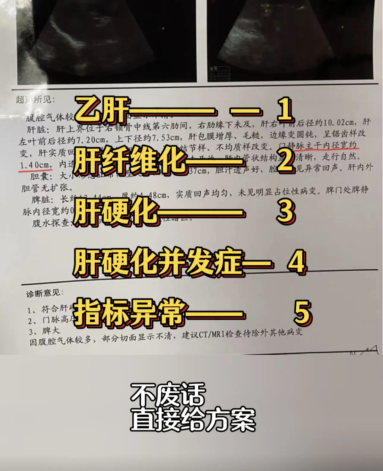 乙肝 肝硬化 肝癌 医者仁心 健康