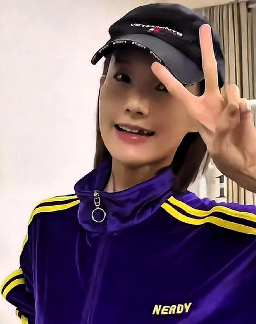 李一桐在拍戏时意外磕掉一颗牙，竟然还因此成了宋丹丹的表情包，这一事件引发了广泛讨