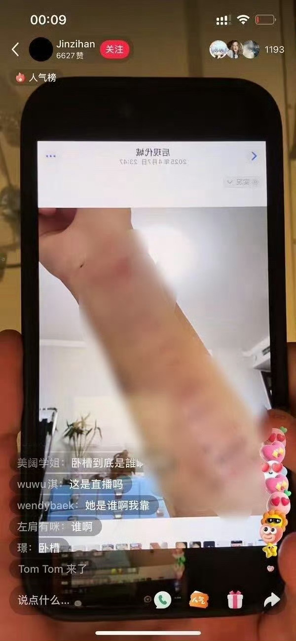 金子涵四月份的时候直播晒自己的手臂，上面全是痕迹。金子涵发明星名单