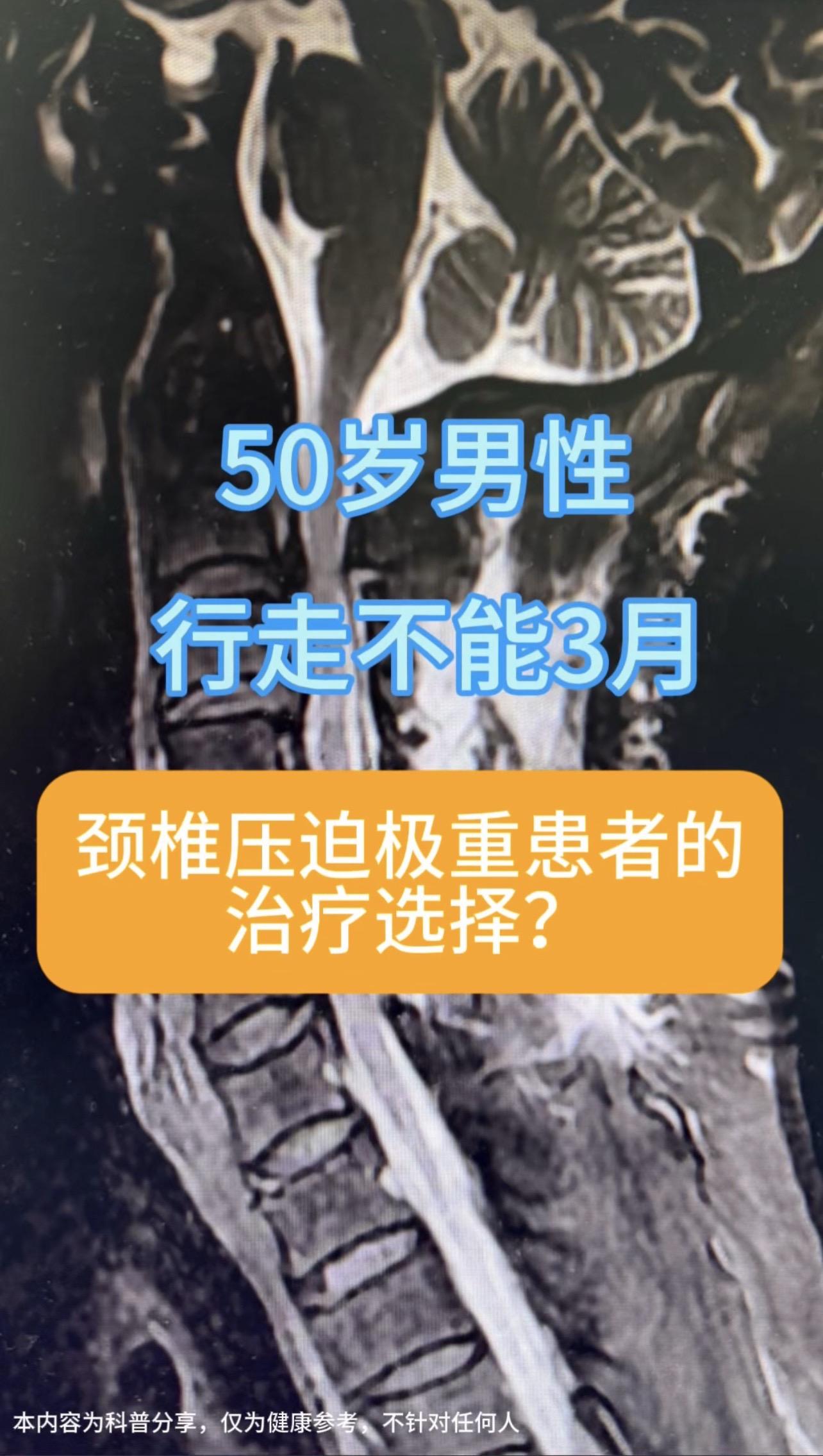颈椎压迫极重患者的治疗选择。50岁男性，行走不能3月，轮椅入院。术前颈...