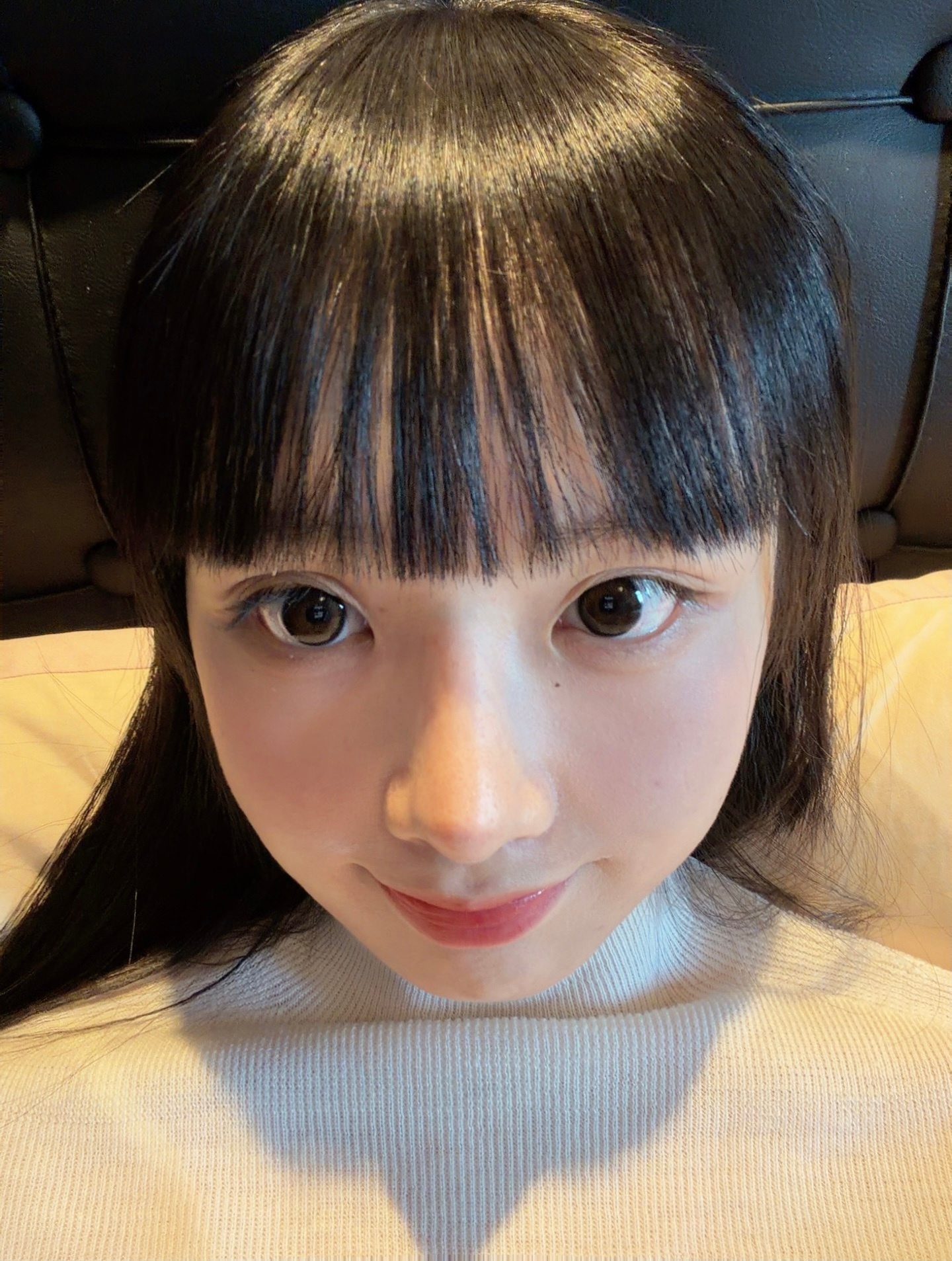 浅浅填下鼻基底 减轻三岁有余