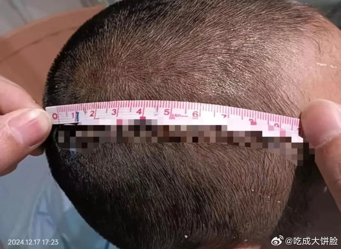 以为孙女被打爷爷将男童砍致重伤一次孩子之间的打闹，最后却变成一场几乎夺命的悲剧。