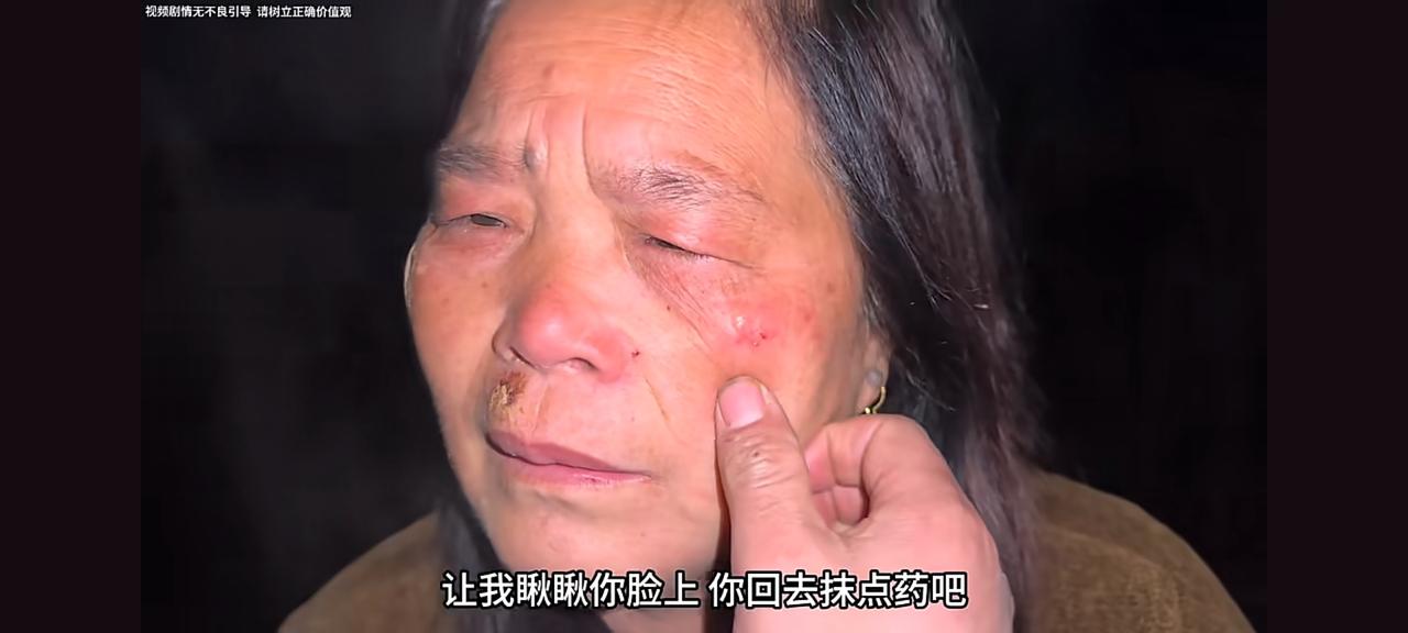 老壳子雪上加霜
刚刚出车祸，脸上和腿上都有撞伤，回到家里都没好气，李佳“幸灾乐祸