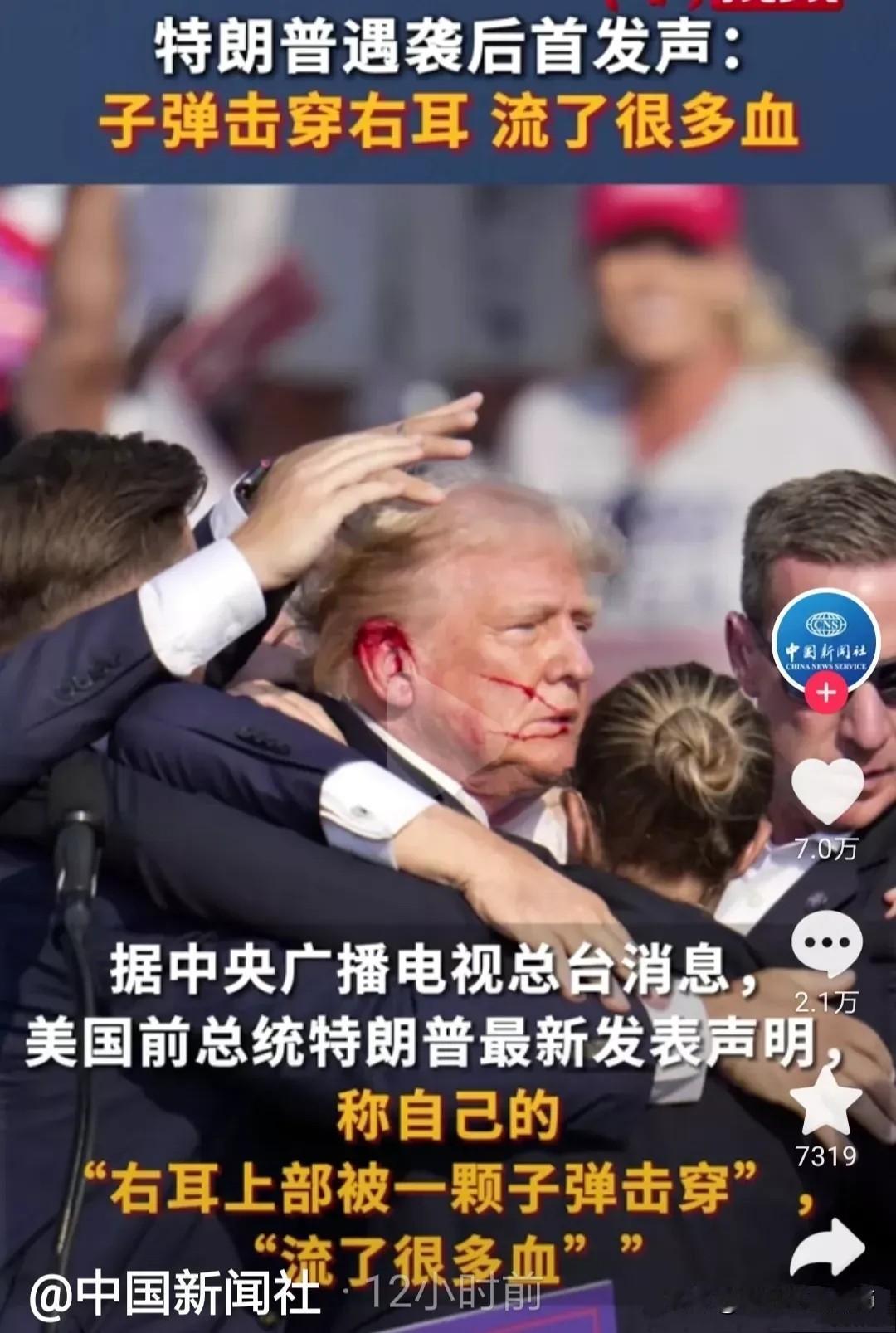 大家还记不记得，一年前特朗普在一次演讲中遇袭，右耳上部被一颗子弹击穿，险些丧命。