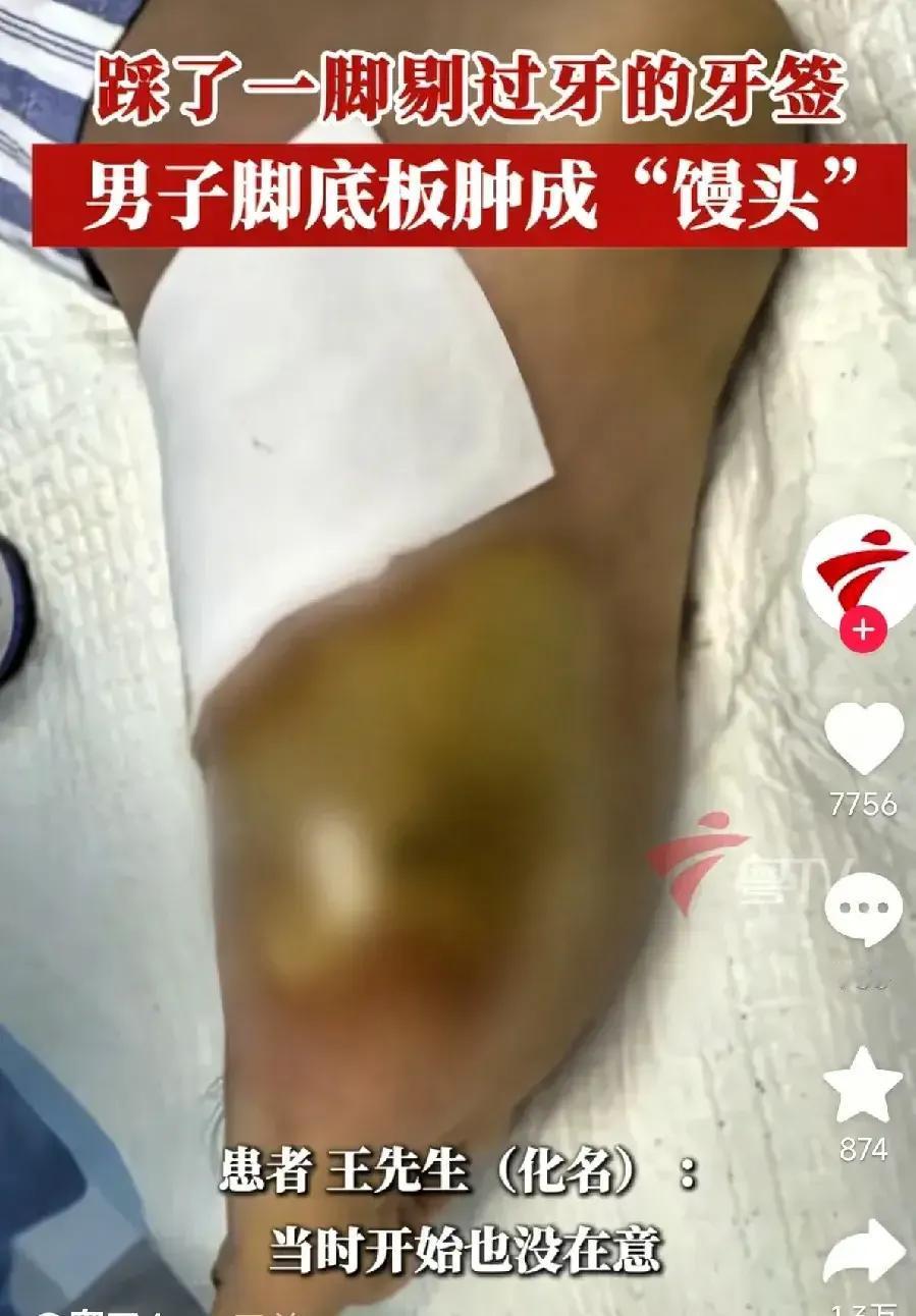 悲剧还是发生了！广东深圳，一男子饭后用牙签剔牙，之后顺手把牙签一扔，一个没注意就