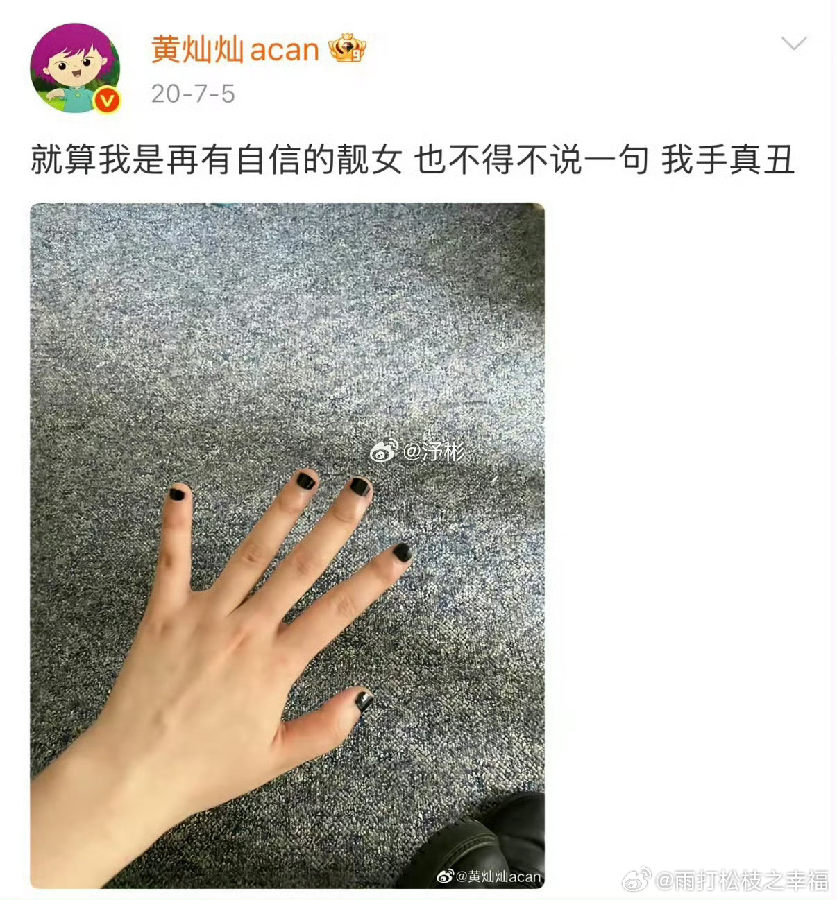 黄灿灿370元做的丑美甲黄灿灿花费三百多元做美甲，成品效果粗糙，甲型未经修整，引