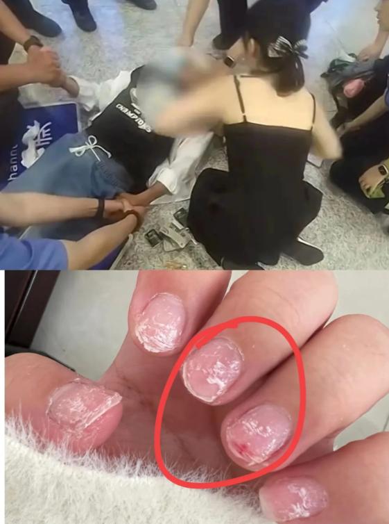 我老公不明白，只是急救了一个病人，
这护士为啥一下子就火了？
我说，你看看强力卸