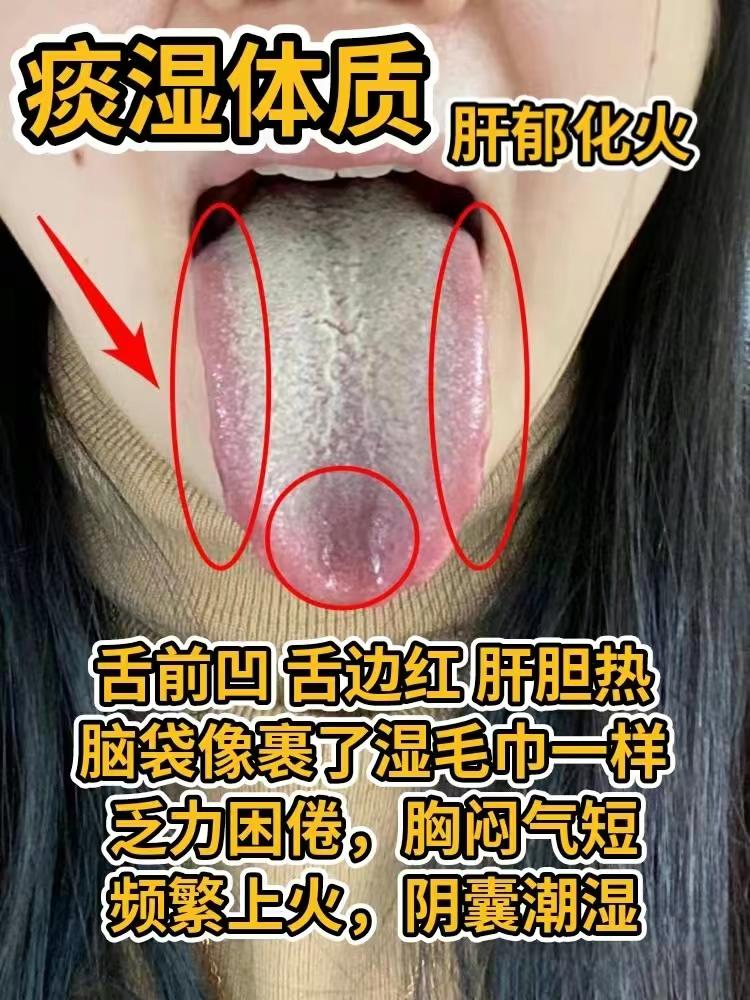 看舌象，只健康！看看你是哪种舌苔，留下挨个分析


#中医##养生#