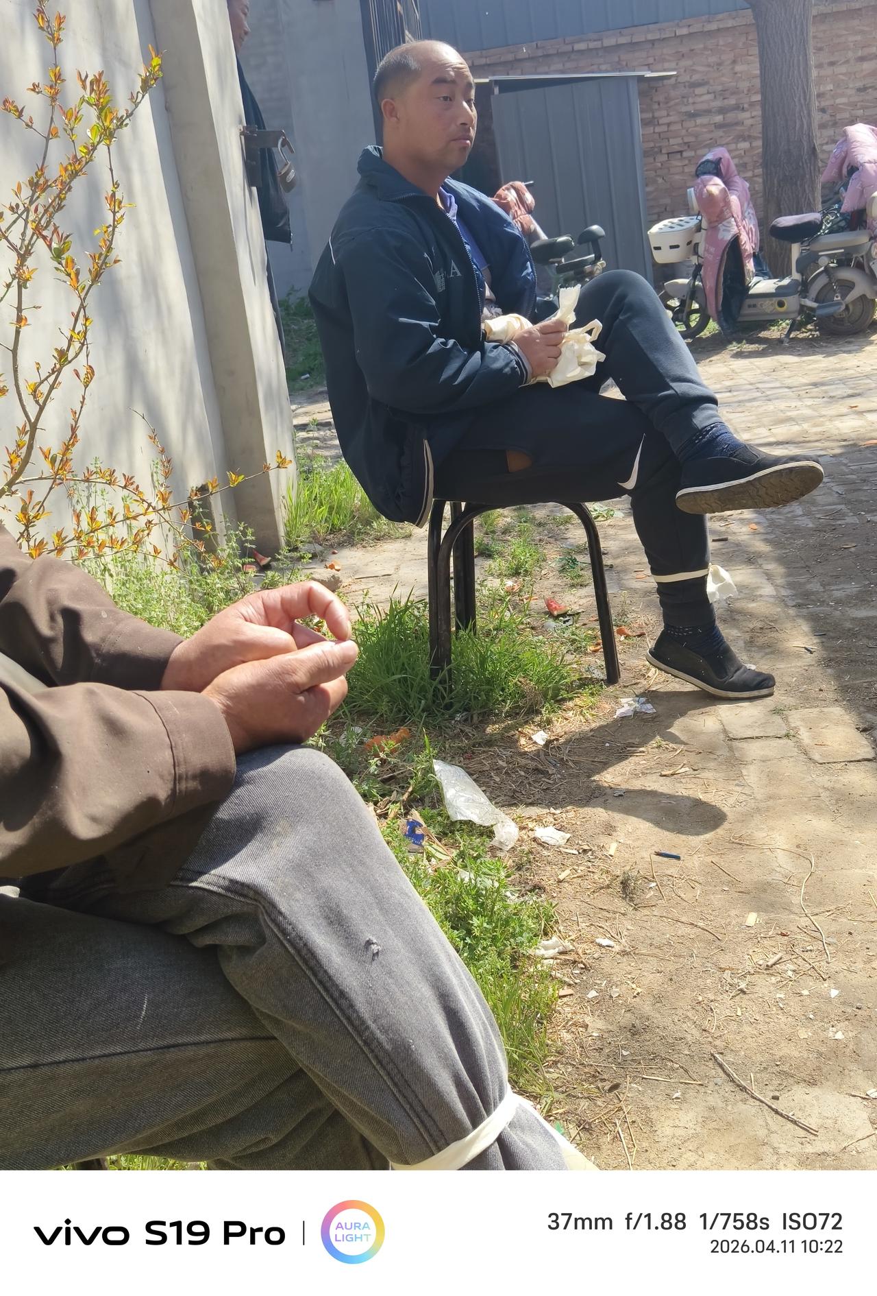 三蛋的头发去哪了……真实的三蛋头发已经濒危绝迹，一个才三十多岁的人，正是年富力强