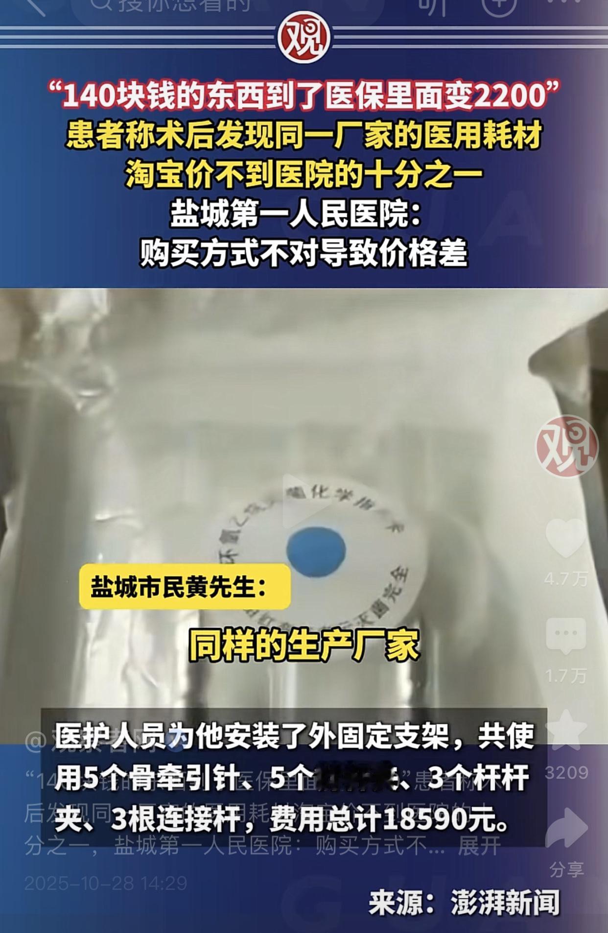 江苏盐城一男子因车祸腿部骨折，在盐城第一人民医院安装了外固定支架！一共使用了5个
