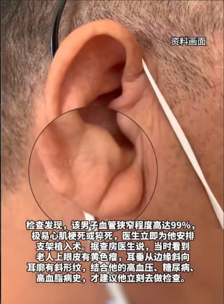 不幸中的万幸！”近日，江苏南京，一七旬老人陪老伴住院，医生在查房时，看了他一眼，