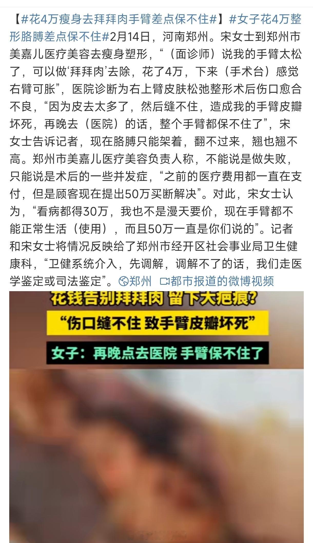 花4万瘦身去拜拜肉手臂差点保不住  这人间哪有捷径可以走？钱可以买到很多东西，甚