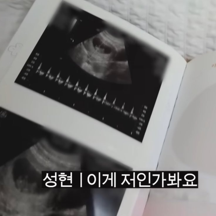 【twi】严成玹公开自己胚胎时期的b超照 
