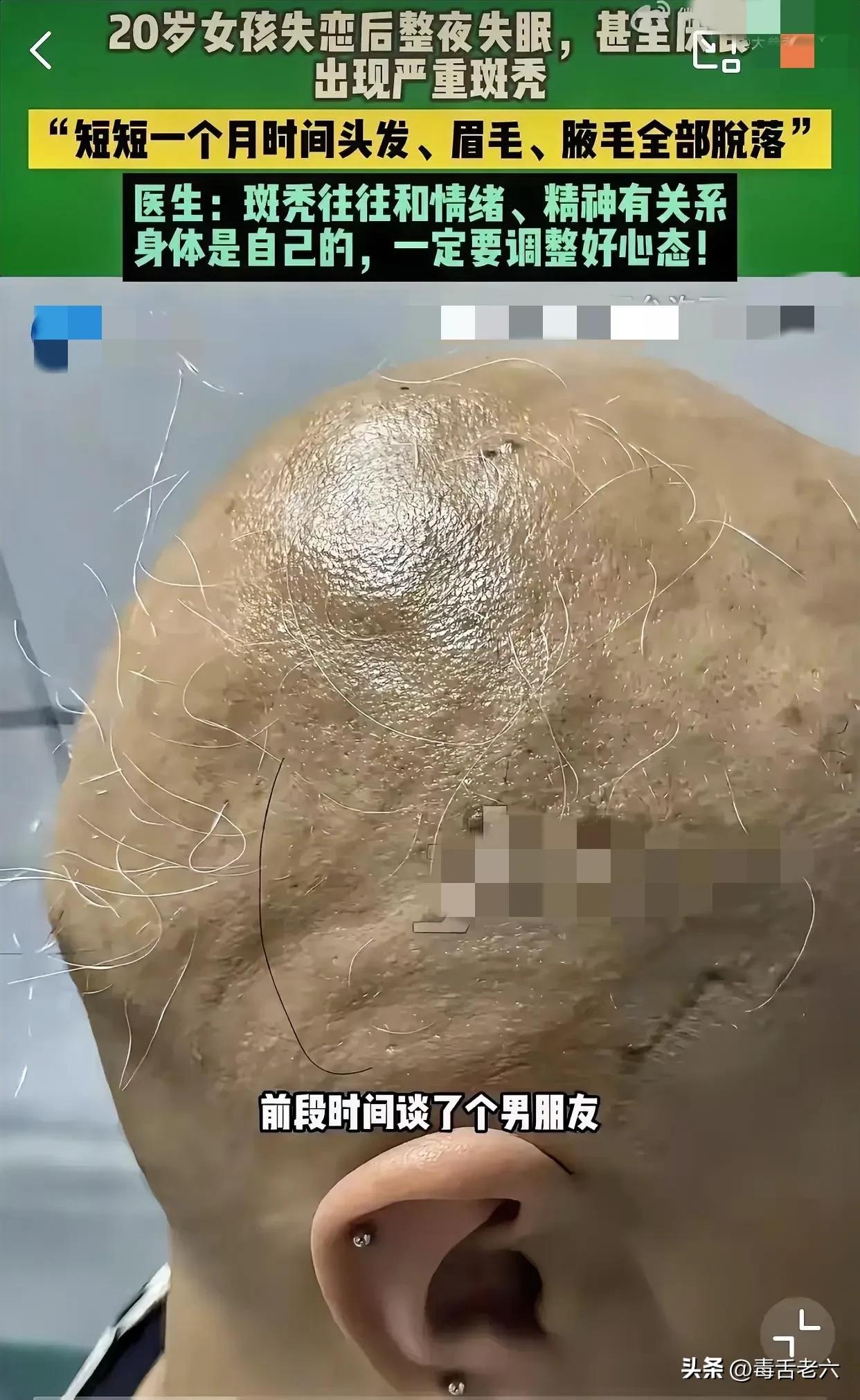 姑娘，想开一些吧！近日河南郑州一位20岁的姑娘，结识了一位男生后，姑娘迅速坠入爱