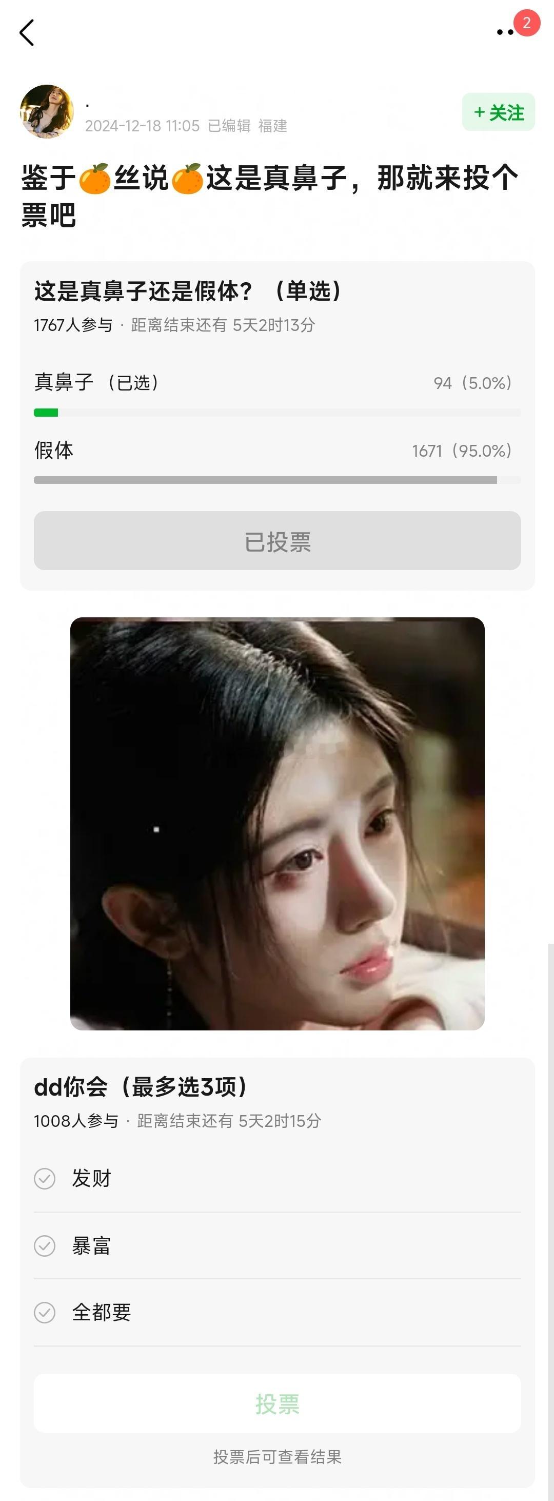🌸渣在热议鞠婧祎的鼻子👃🏻，你们觉得真or假？ 
