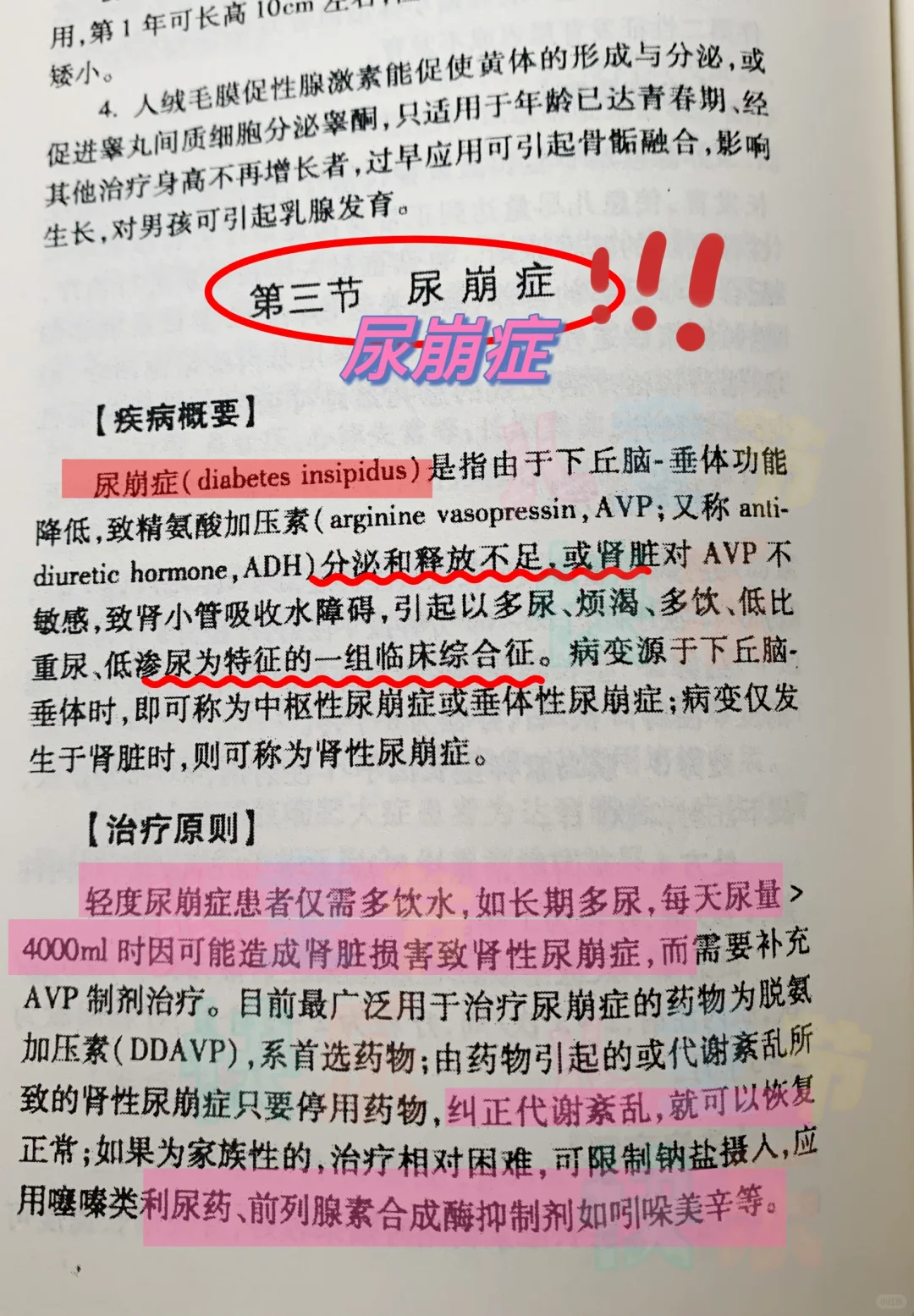 尿崩症