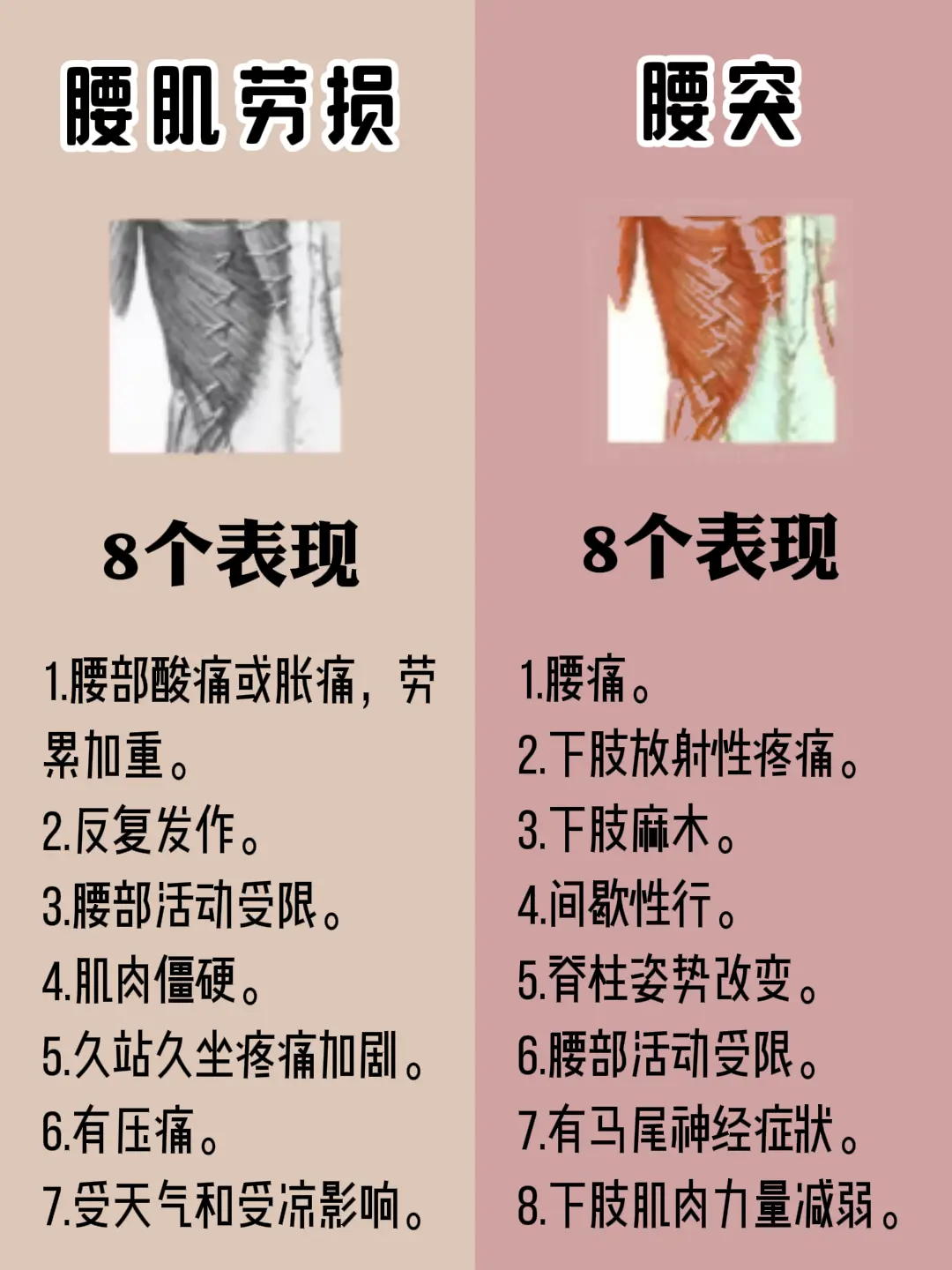 腰肌劳损 腰突 区别这就是区别