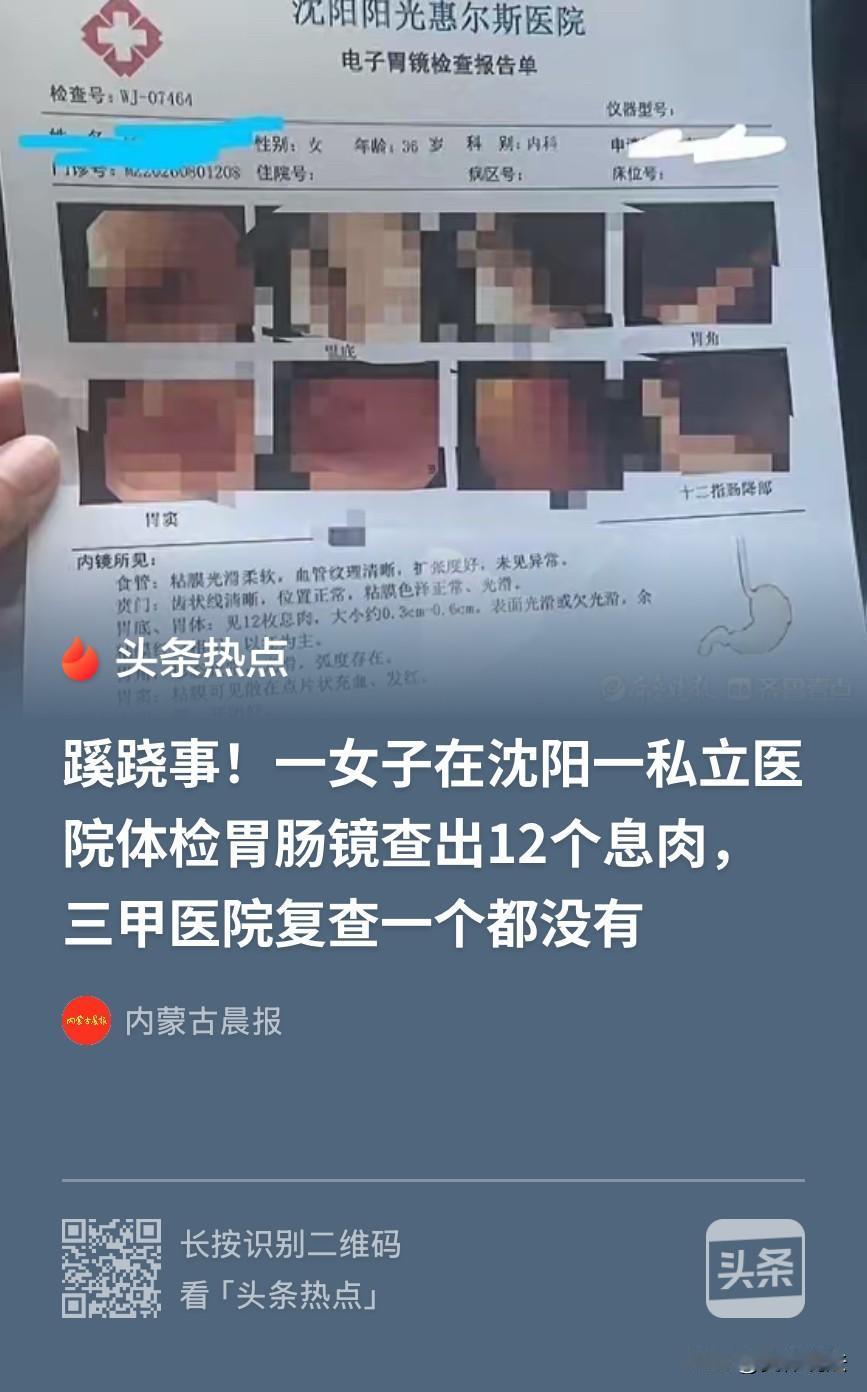 “离大谱！”辽宁沈阳，一女子在一私立医院体检时，被告知胃部有12个息肉需要切除，