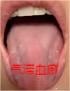 养肝我不用逍遥丸，分享3个更好的，不仅疏肝理气，还能活血化瘀、清肝泻火、清热利湿