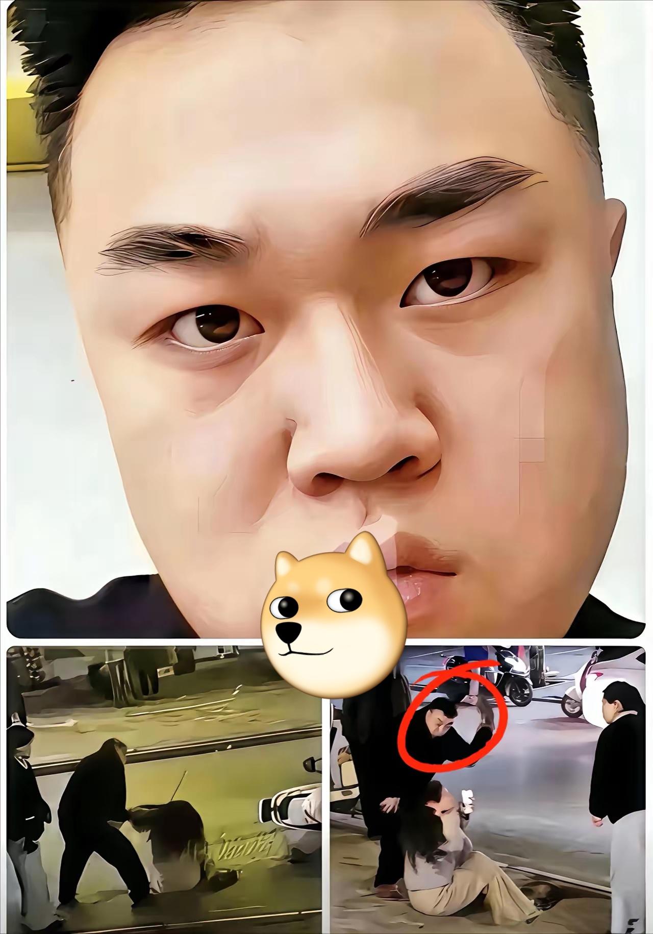 一张轻伤二级的鉴定书
直接把对方的天灵盖给掀开了！

平日里不是嚣张跋扈吗？不是