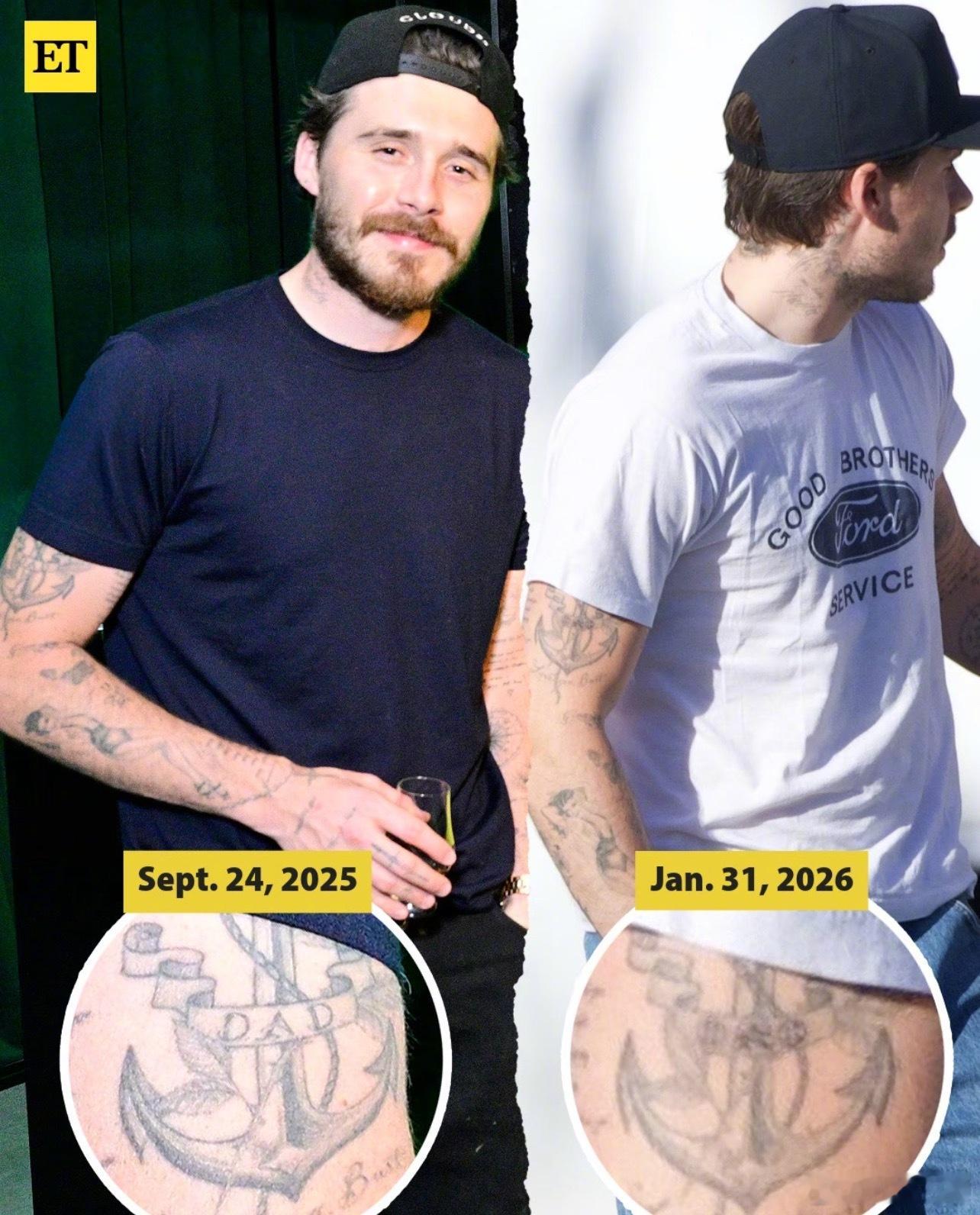 贝克汉姆大儿子布鲁克林把手臂上“DAD”（爸爸）字样的纹身遮盖掉了 