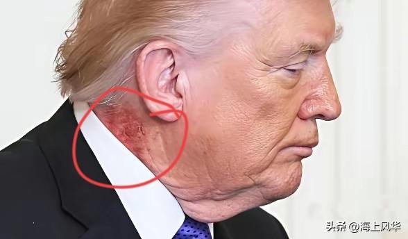 特朗普最近状况真不少，脖子又被拍到红一片，白宫只说是皮肤病，轻描淡写就过去了。再