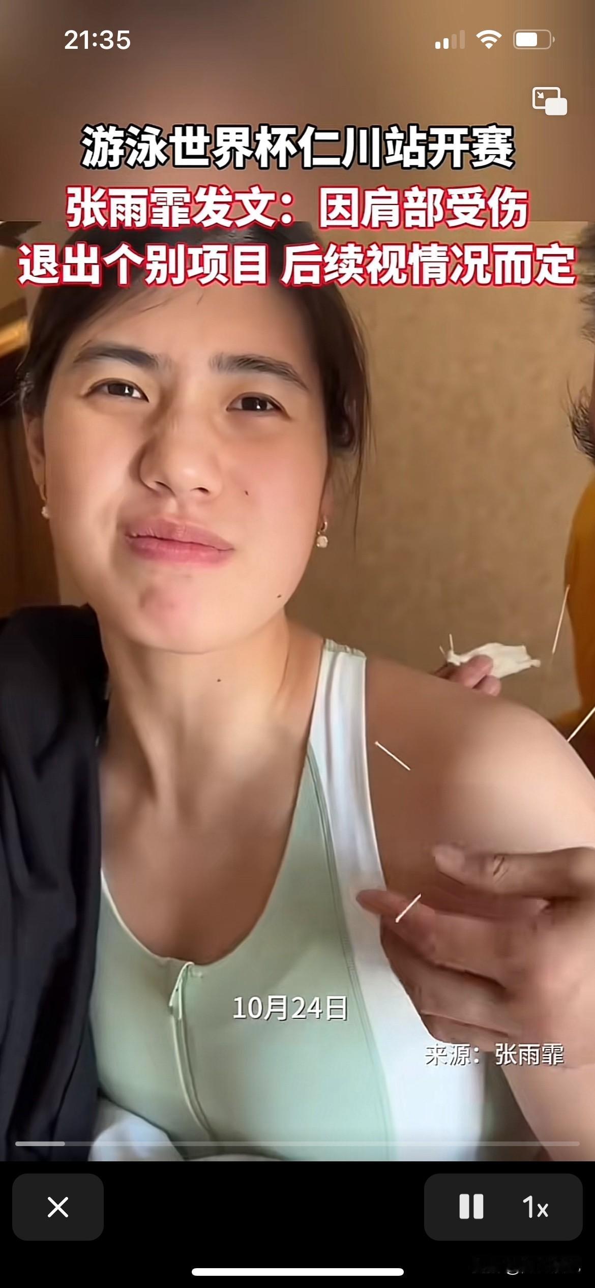 张雨霏这个小女孩太不容易了，看看这身伤病，真的是拼命为国争光，这种针直接插肉里，