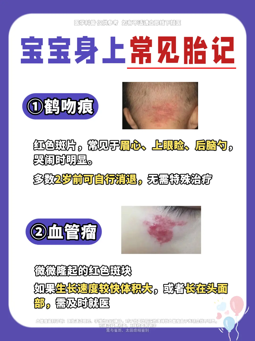 自查！宝宝胎记哪些需要看医生？快码住~。