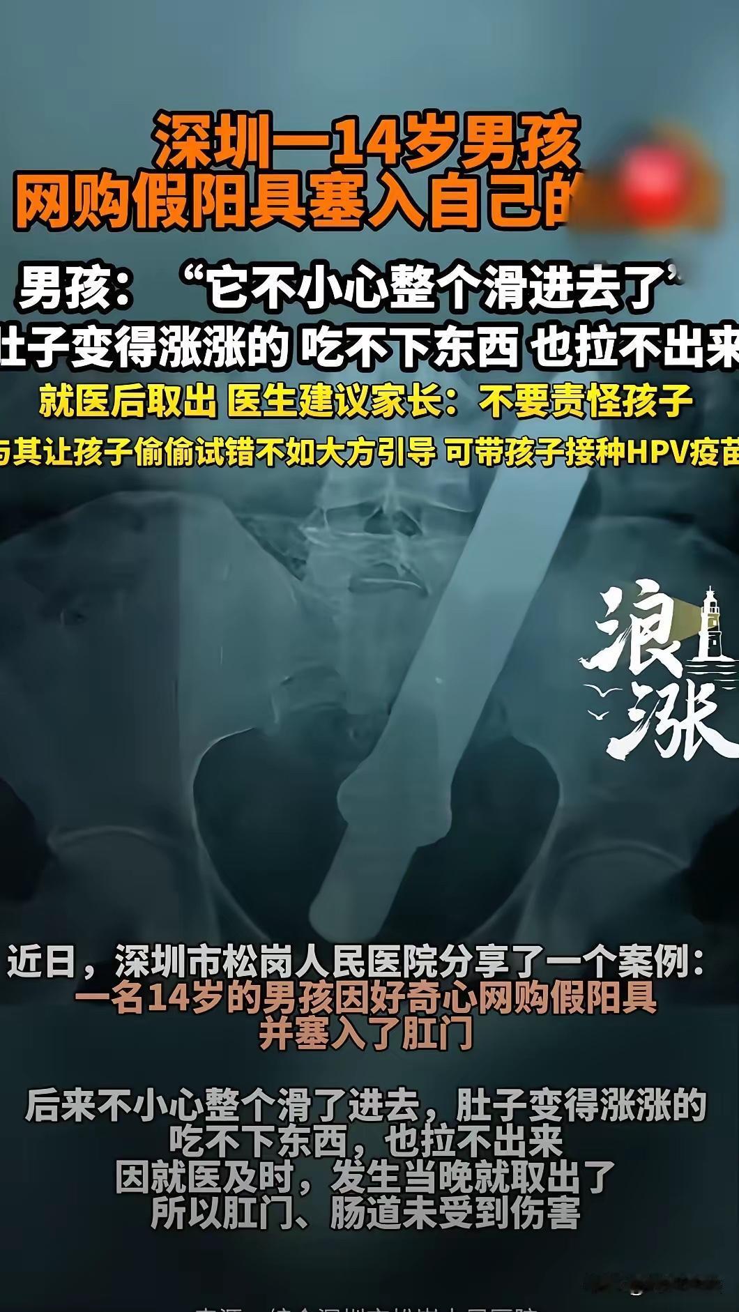 14岁男孩因好奇闯祸，医生一句话点醒无数家长

好尴尬！广东深圳，14岁小男孩对