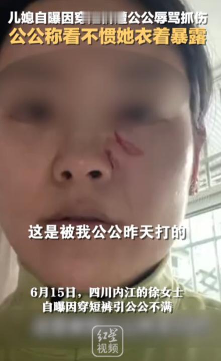 “清官难断家务事！”2023年，四川，一儿媳因天气热穿了条白色短裤，竟被50多岁