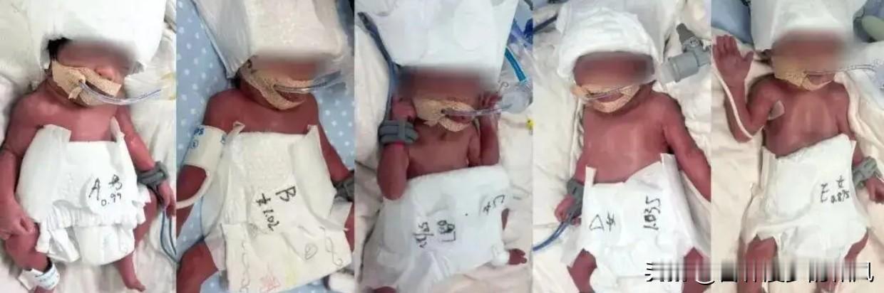 五千万分之一！新疆妈妈在武汉医院一胎生下五个娃，1男4女！这运气，简直比中彩票还