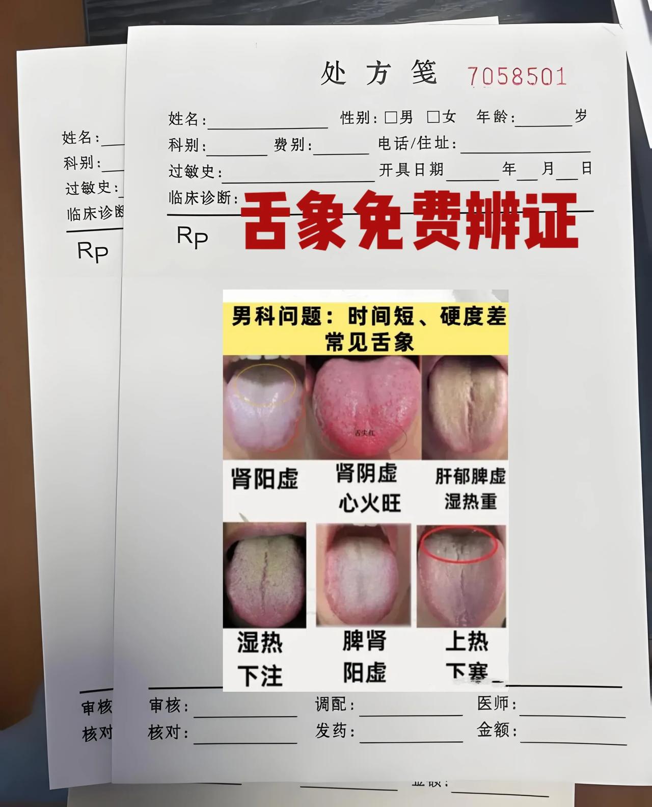 舌头齿痕多到如同“啤酒盖”，你以为是脾虚湿气重吗？

患者主诉：情绪低落、总是唉