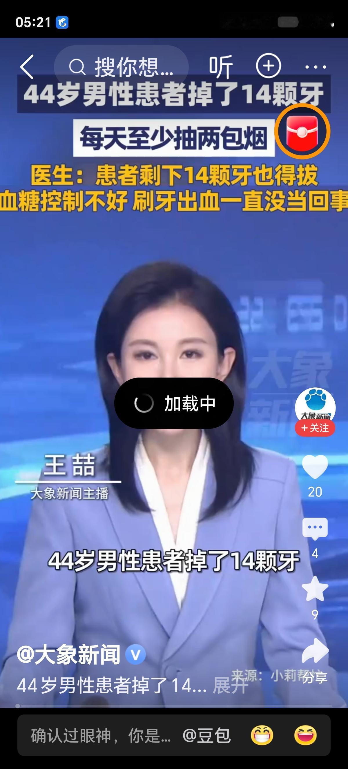 重度烟民掉14颗牙，还得再拔14颗！别用侥幸，赌上后半生的健康
一口牙齿，掉了一