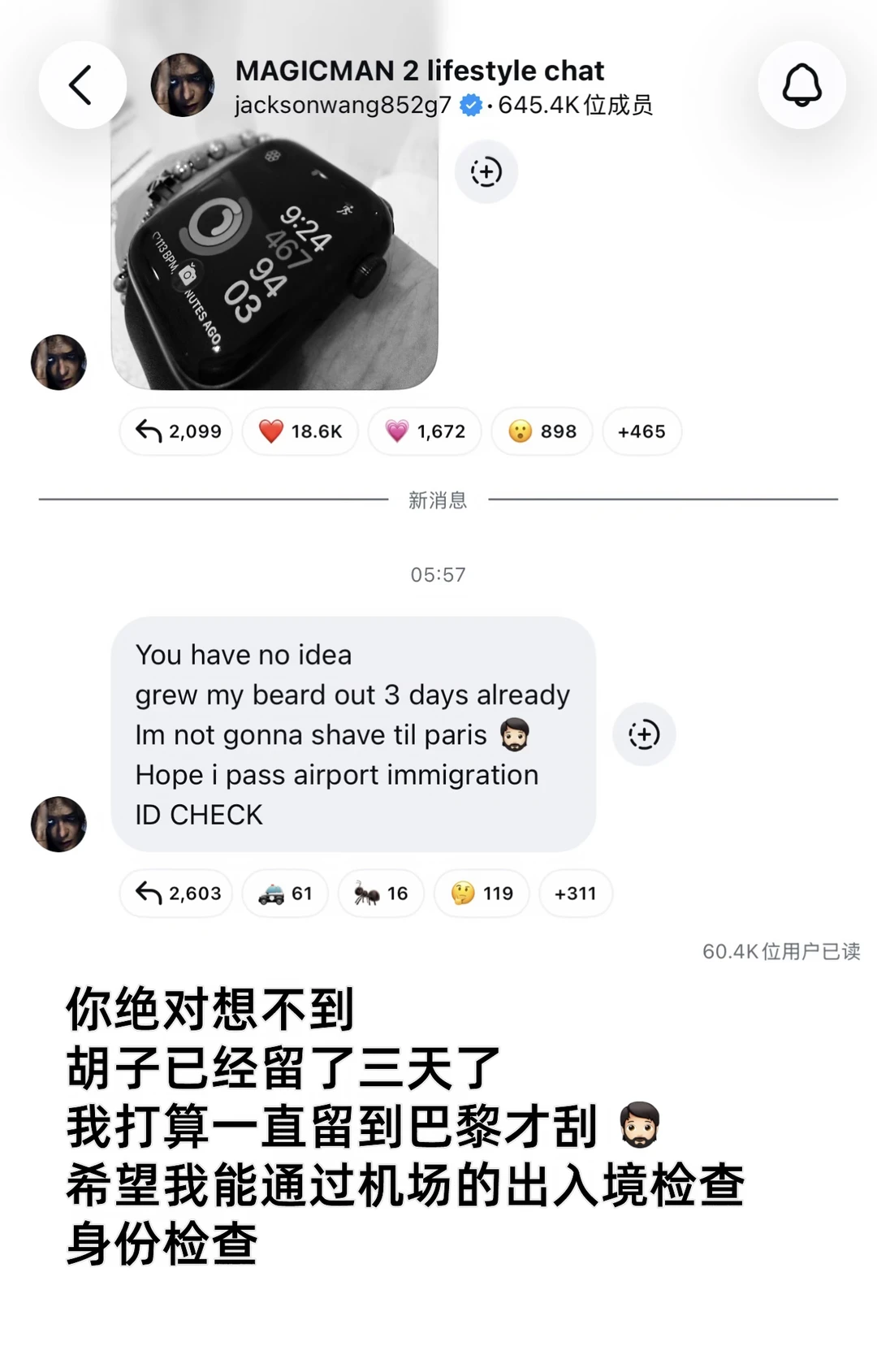 嘉尔三天没刮胡子🧔🏻