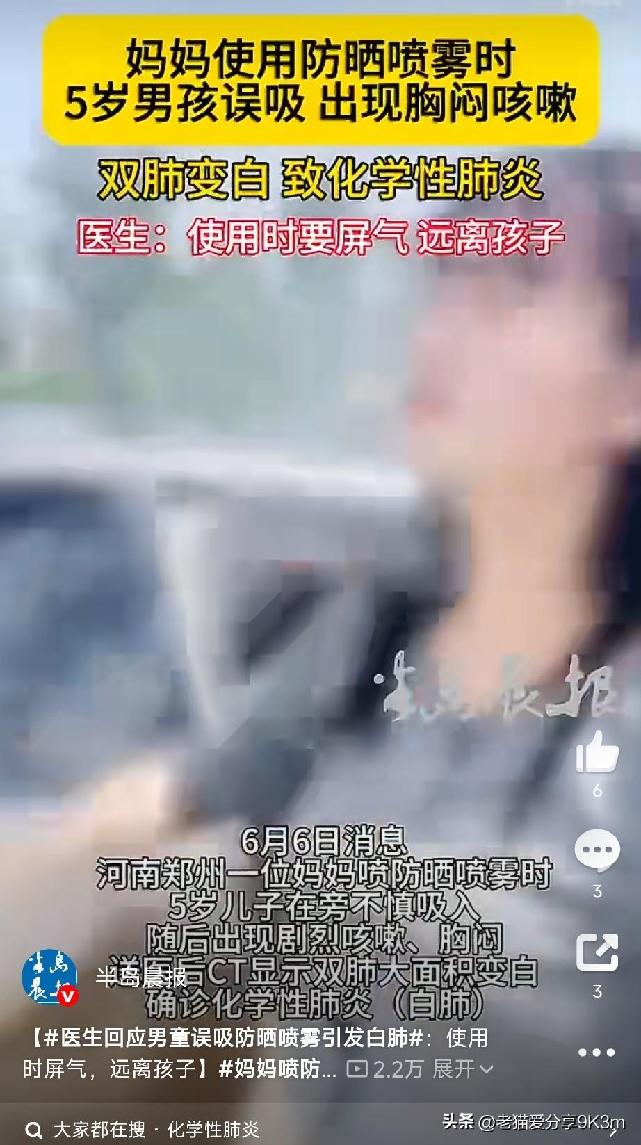 妈妈喷防晒喷雾，5岁儿子直接“白肺”！

河南郑州，一个5岁的小男孩，因为妈妈在