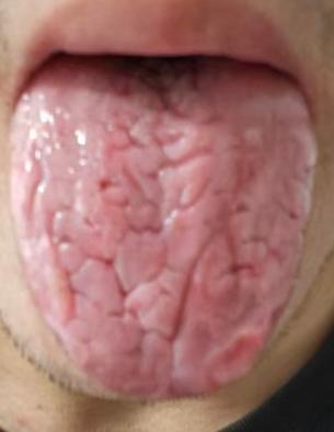固摄精关，助力海绵体平稳调养





对于男同志而言最忌讳的问题就是出现精关不