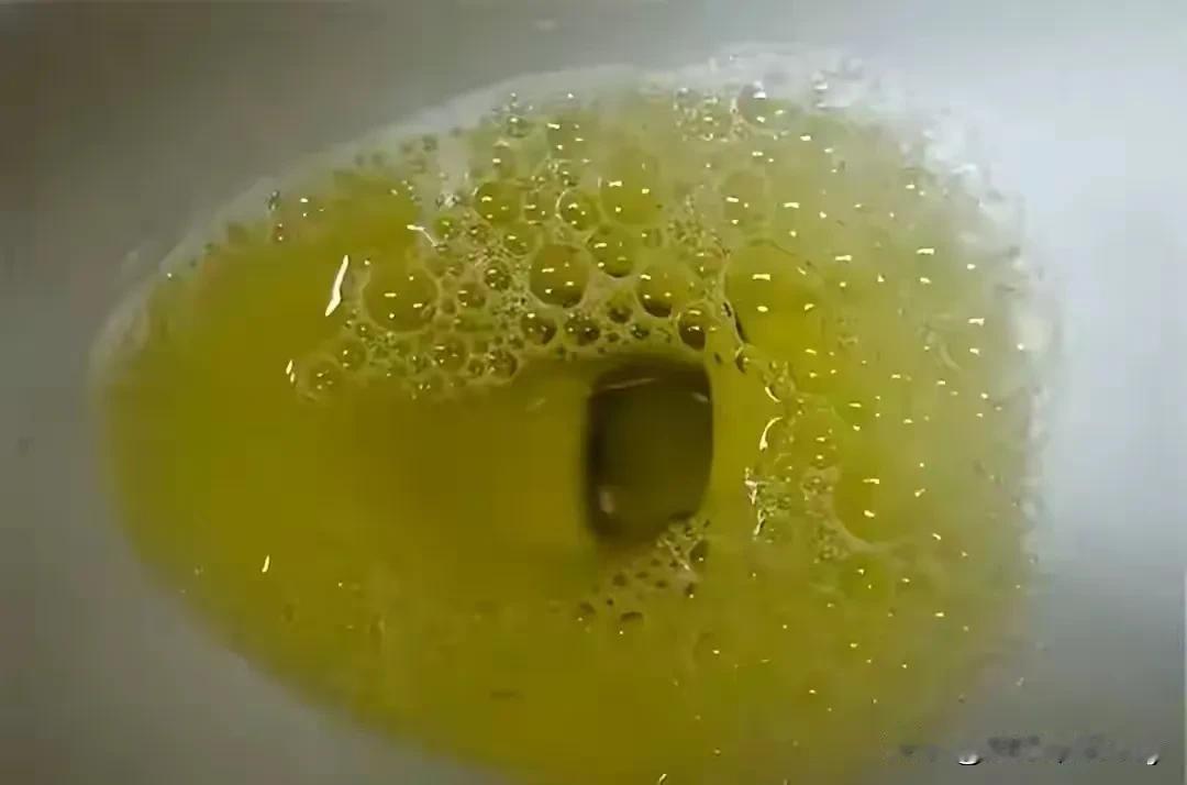 一提到糖尿病这种让人颇为苦恼的病，每天就时时刻刻关注着这方面的信息。这不，今天又