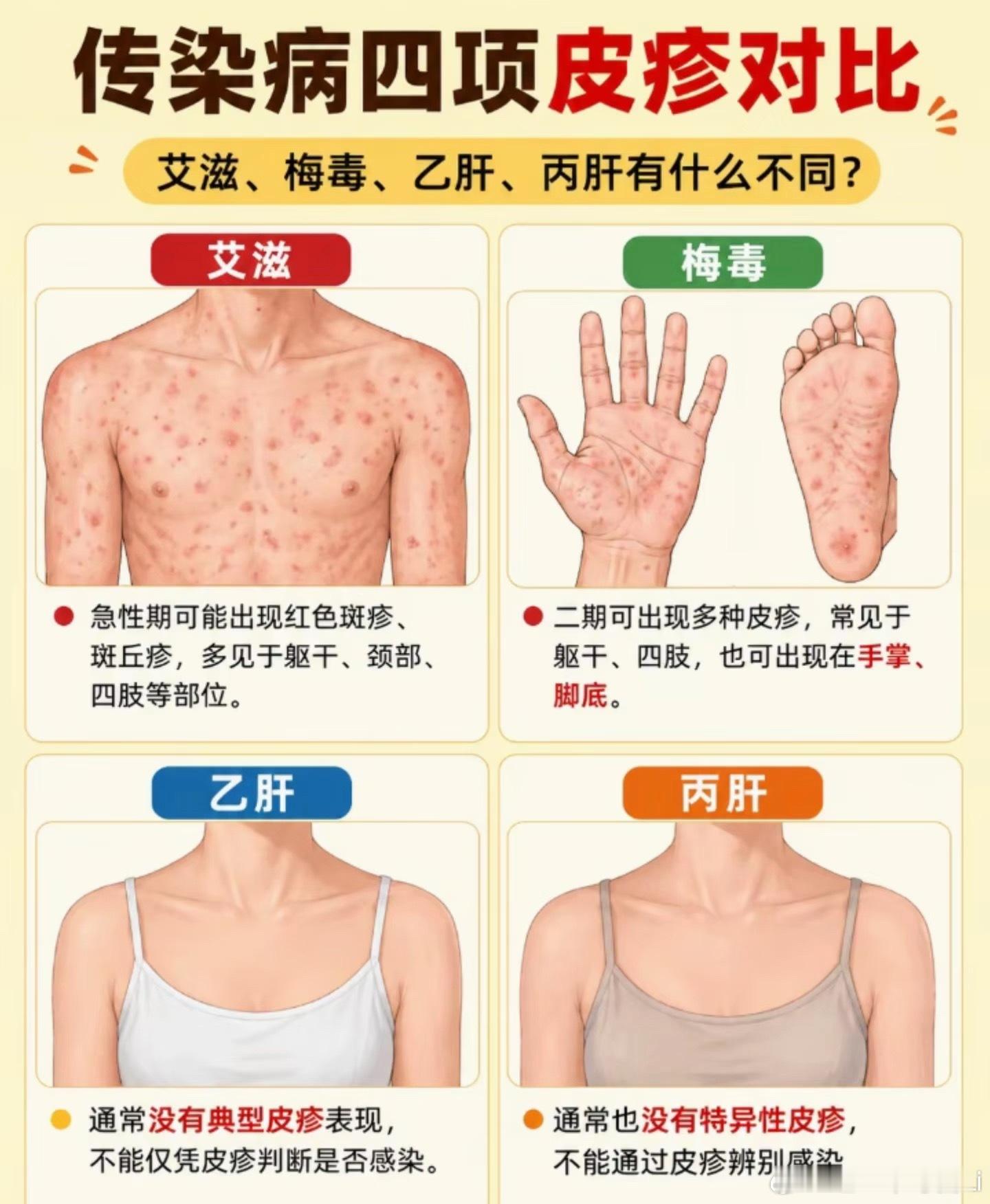 梅毒被称为皮肤性病科模仿大师医学界叫它“伟大模仿者”，二期梅毒疹形态千变万化，能