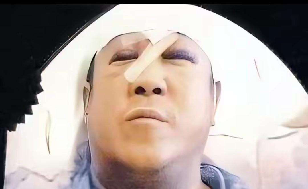 曾志伟被围殴，头上缝了29针。谭咏麟悬赏百万缉凶，结果查到最后，圈内所有人都沉默