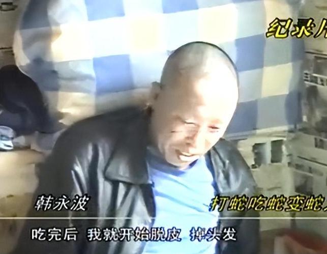 你敢相信吗，有人吃了蛇肉后，皮肤就如同蛇蜕皮一样发生了巨大的变化，全身都开始变黑