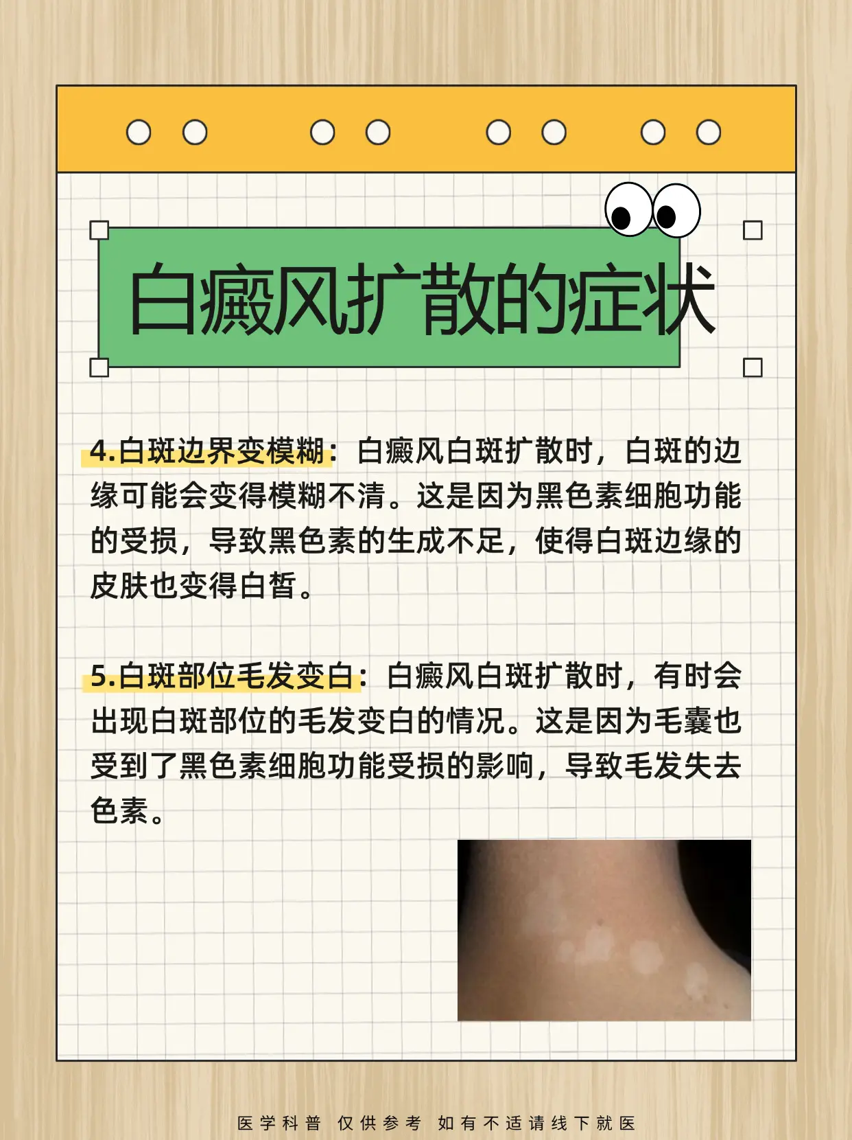 医学科普 白癜风 白癜风科普 硬核健康科普行动  白斑