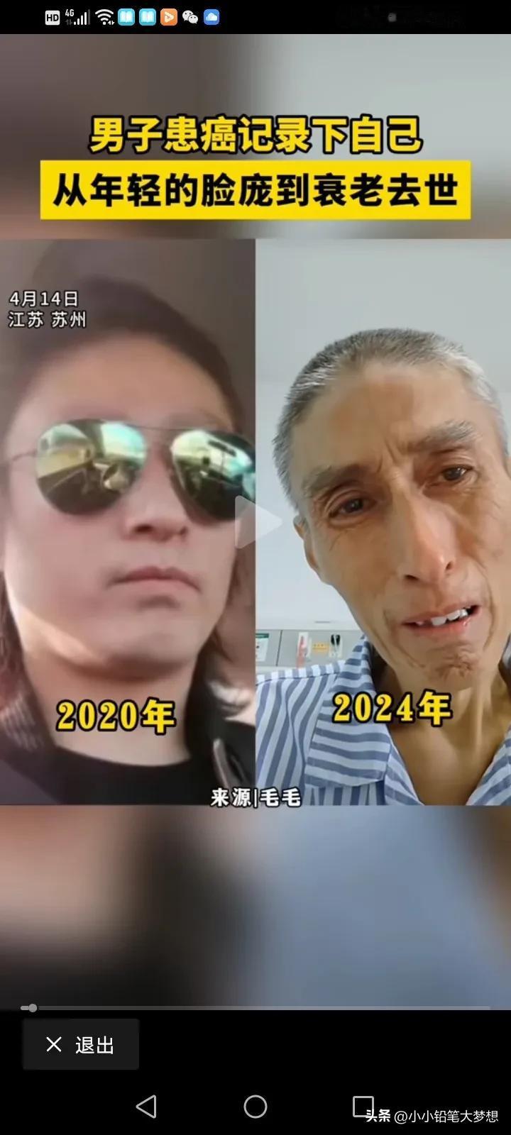 谁能想象这是同一个人呢？一名男子记录自己抗癌后容貌的变化，短短的四年，病魔是有多