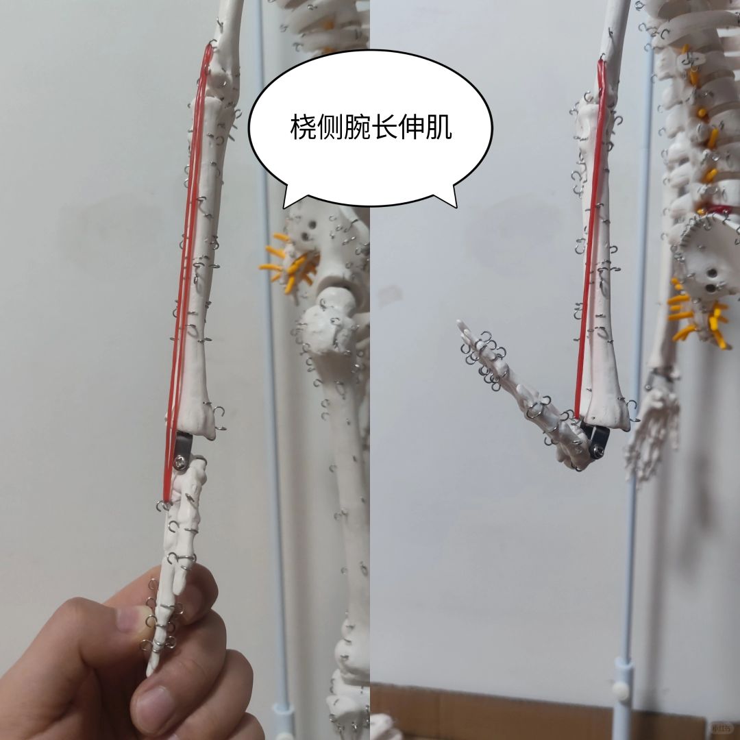 桡侧腕长伸肌