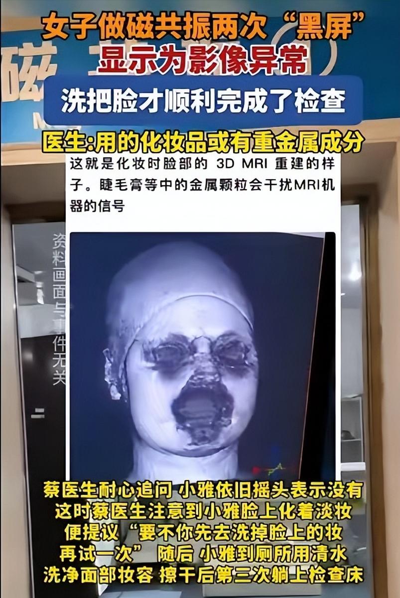 解释不清了！福建一29岁女生头晕，去医院做头颅磁共振。不料，连续2次扫描，都因面