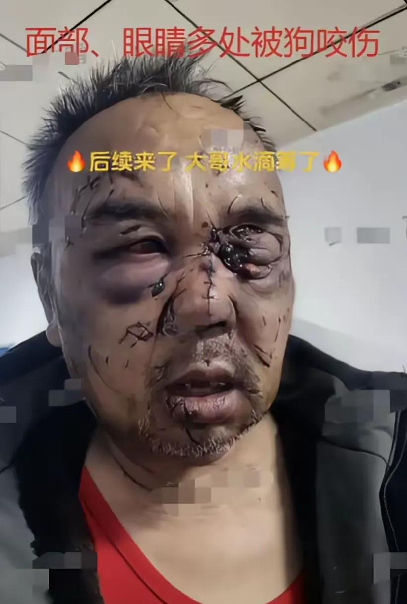 山西大同发生了一起骇人听闻的狗咬主人事件，主人被咬得遍体鳞伤，血流如注。我的第一