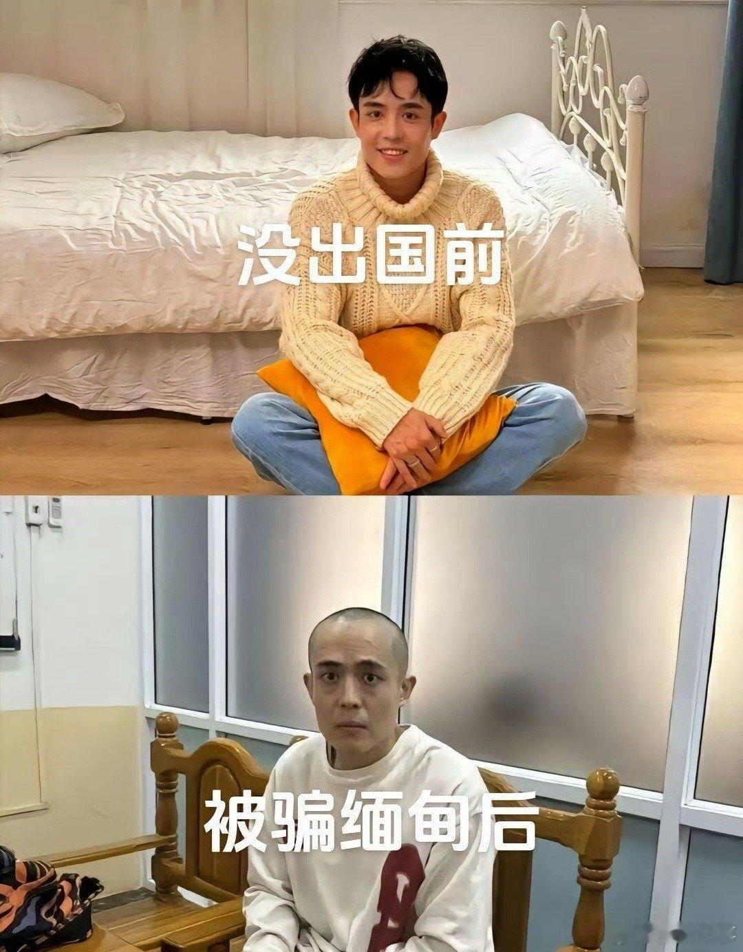 王星没出国前的样子和回国后的样子 ，看着都后怕，这是受到了什么样的待遇？ 