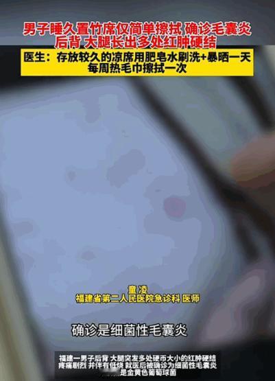 太吓人了！福建，一男子天热图省事，把放了一年的竹席拿出来，随便擦了擦就直接躺了上